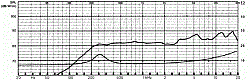 Потолочный громкоговоритель 5 см, 8 Ом, IP 54  (Art.50097) - фото 201007