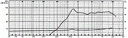 Головка динамическая ВЧ 80 Watt (12 dB/Okt. 5000 Hz), 8 Ом, > 5000 Hz, 90дБ  (Art.9002) - фото 201170
